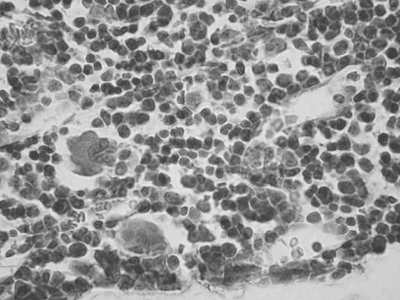 Monocyty migrują do tkanek, gdzie przekształcają się w makrofagi lub komórki prezentujące antygen Płytki krwi inicjują proces krzepnięcia krwi średnica 15-20 μm nerkowate jądro dobrze rozwinięte