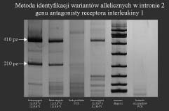 P R A C E O R Y G I N A L N E Ginekol Pol. 2009, 80, 111-117 Kalinka J, et al. Otrzymano produkty d ugoêci 410 pz (IL1RN*1), 240pz (IL1RN*2), 500pz (IL1RN*3).