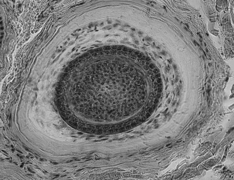 tkanka łączna wiotka - zawiera y, korzenie włosów, naczynia, mechanoreceptory 2. Komórki uczestniczące w procesach obronnych: keratynocyty kom.