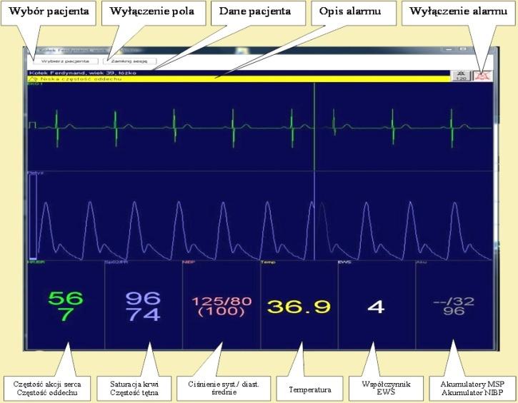 ZAKŁAD TECHNIK DIAGNOSTYCZNYCH Elektrokardiograf