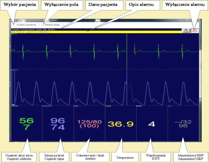 ZAKŁAD TECHNIK DIAGNOSTYCZNYCH Elektrokardiograf