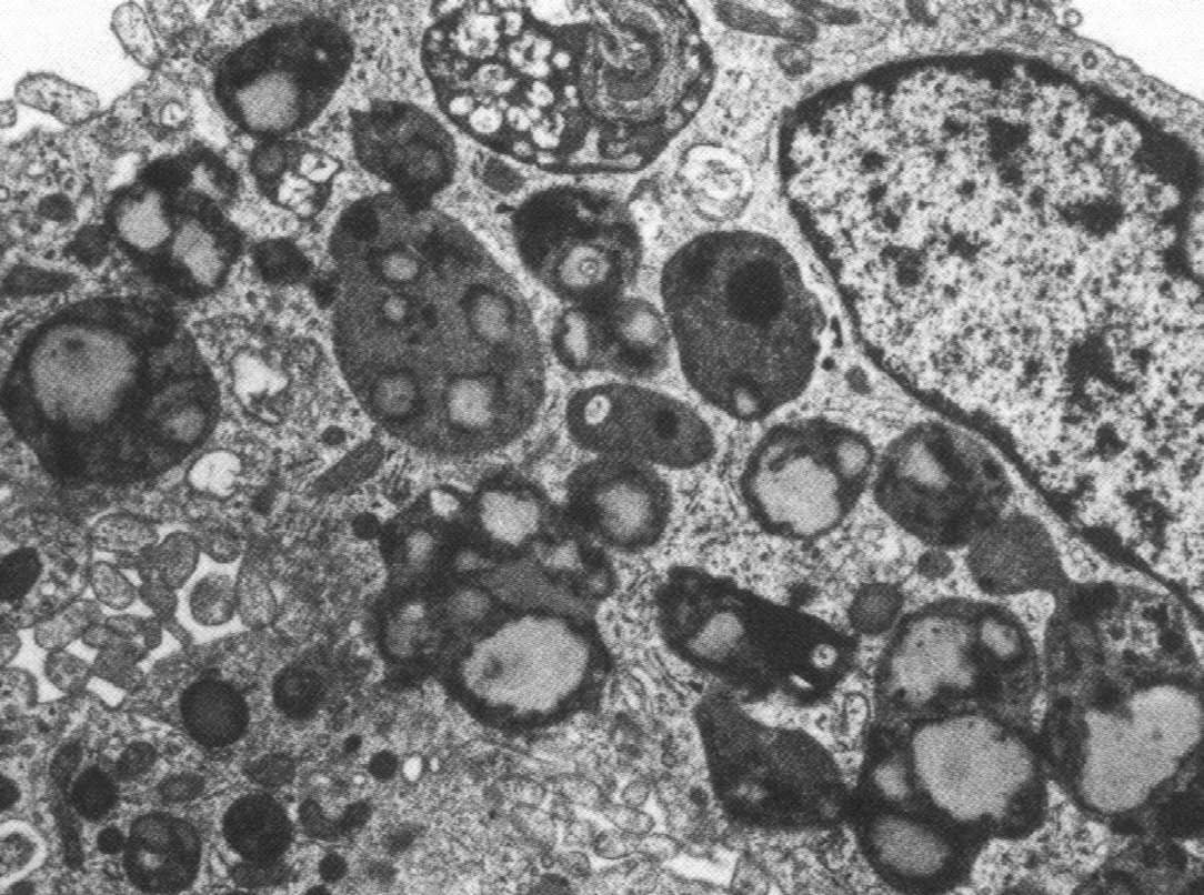 Lizosomy pęcherzyki, w których zachodzi trawienie wewnątrzkomórkowe; zawierają enzymy trawienne (hydrolazy) i trawione substancje Znaczenie endocytozy receptorowej: wybiórcze pobieranie niektórych