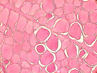 Gjewsk-Szczerbl H., Krzywdzińsk-Brtkowik M., Jrmołowsk-Jurczyszyn D., 2009. Chnges in pork muscles structure prmeters in the course of curing nd psteuristion. Nuk Przyr. Technol. 3, 4, #127.