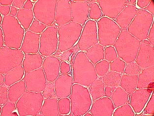 4 Gjewsk-Szczerbl H., Krzywdzińsk-Brtkowik M., Jrmołowsk-Jurczyszyn D., 2009. Chnges in pork muscles structure prmeters in the course of curing nd psteuristion. Nuk Przyr. Technol. 3, 4, #127.