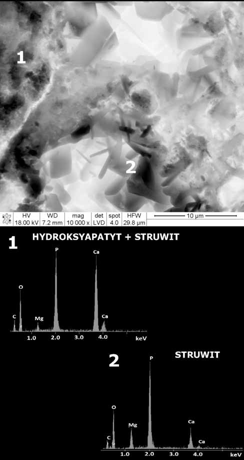 MIKROSTRUKTURA, SK AD FAZOWY I WYTRZYMA O MECHANICZNA NOWYCH SUBSTYTUTÓW KOSTNYCH OPARTYCH NA... Rys. 5. Obraz SEM i analiza EDS w mikroobszarach próbki HCM2 24 godziny po zwi zaniu i stwardnieniu.