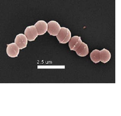 Lactobacillus delbrueckii