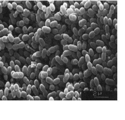 Lactococcus lactis