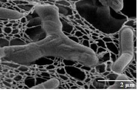 Bifidobacterium longum