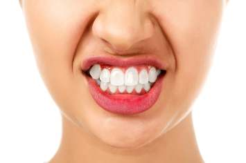 STOMATOLOGIA ESTETYCZNA r u k s i z m t o n a d m i e r n a i Bmimowolna nadaktywność mięśni żwaczy, która prowadzi do coraz mocniejszego zaciskania zębów i zgrzytania nimi.
