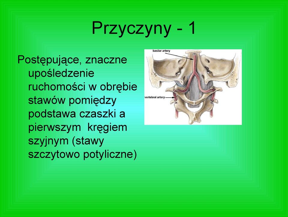 stawów pomiędzy podstawa czaszki a