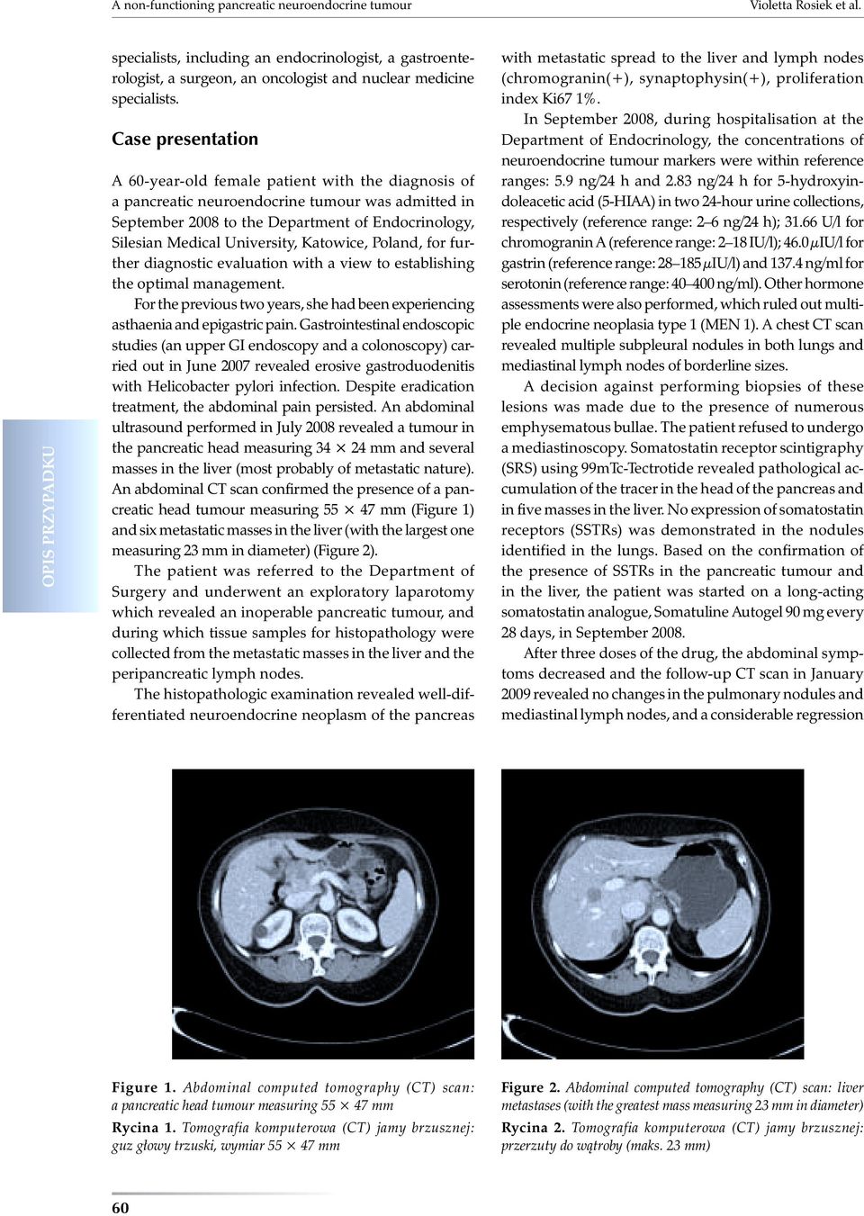 Katowice, Poland, for further diagnostic evaluation with a view to establishing the optimal management. For the previous two years, she had been experiencing asthaenia and epigastric pain.