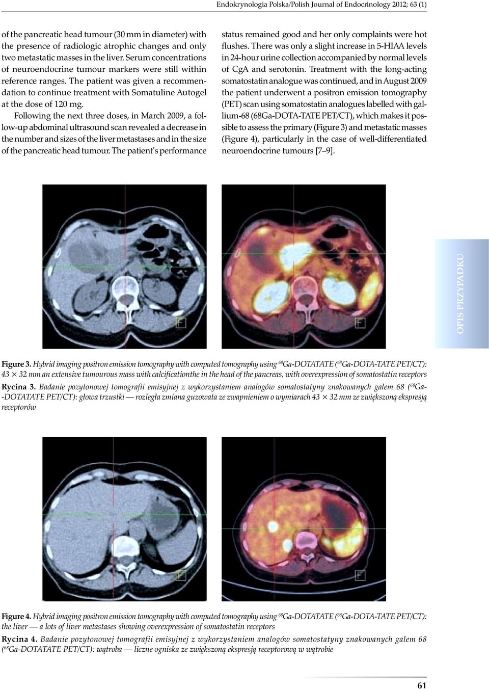 The patient was given a recommendation to continue treatment with Somatuline Autogel at the dose of 120 mg.