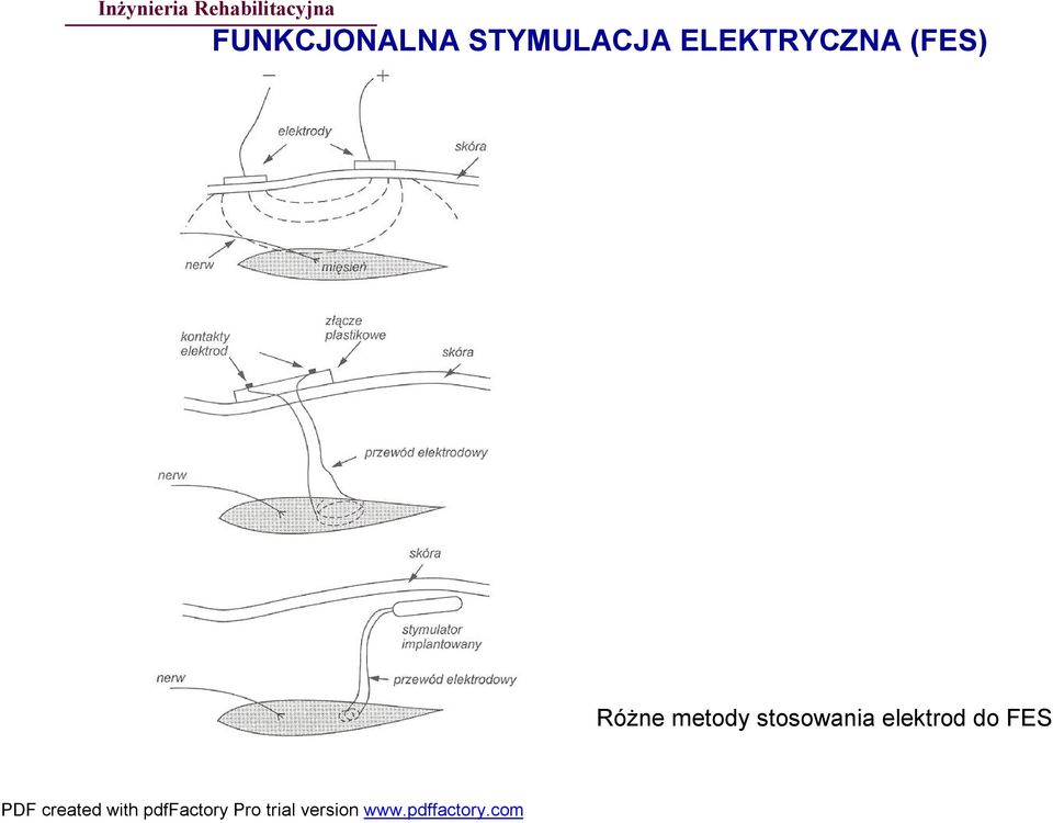 ELEKTRYCZNA (FES)