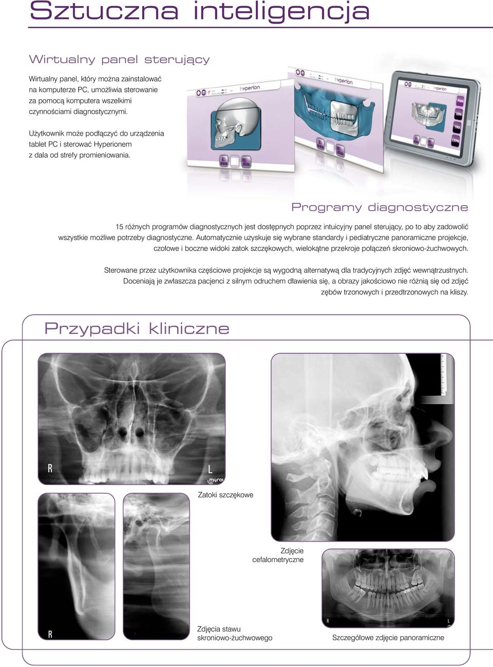 Programy diagnostyczne 15 ró nych programów diagnostycznych jest dost pnych poprzez intuicyjny panel sterujàcy, po to aby zadowoliç wszystkie mo liwe potrzeby diagnostyczne.