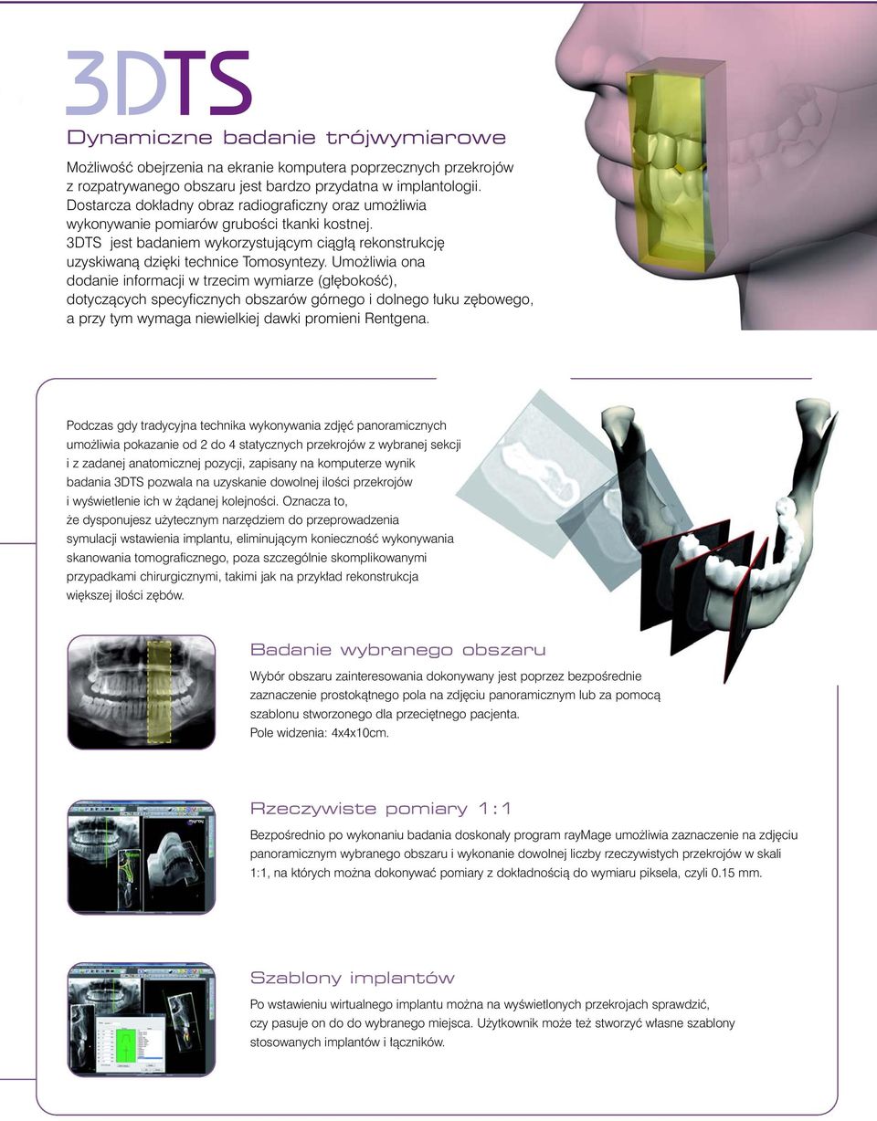 Umo liwia ona dodanie informacji w trzecim wymiarze (g bokoêç), dotyczàcych specyficznych obszarów górnego i dolnego uku z bowego, a przy tym wymaga niewielkiej dawki promieni Rentgena.
