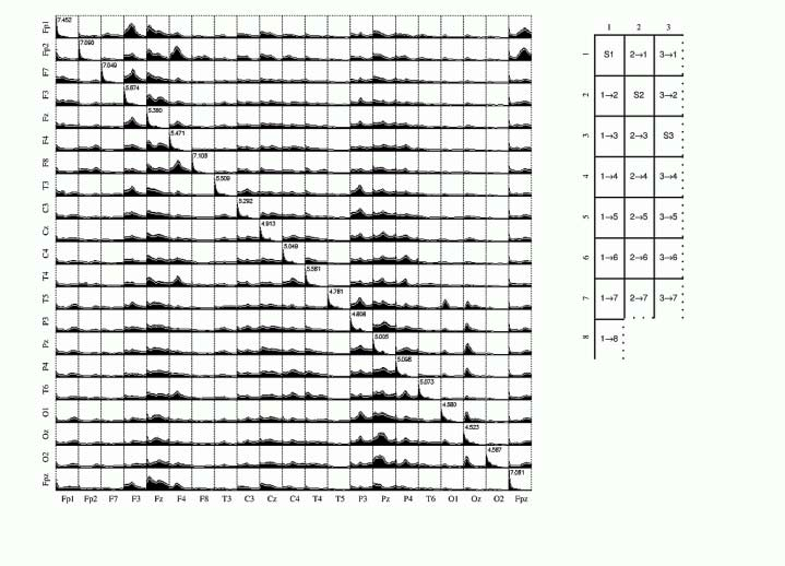 model AR został dopasowany jednocześnie do 21 kanałów EEG ze