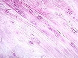 Chrząstka włóknista Chondrocyty małe i ułożone równolegle do przebiegu włókien Substancja
