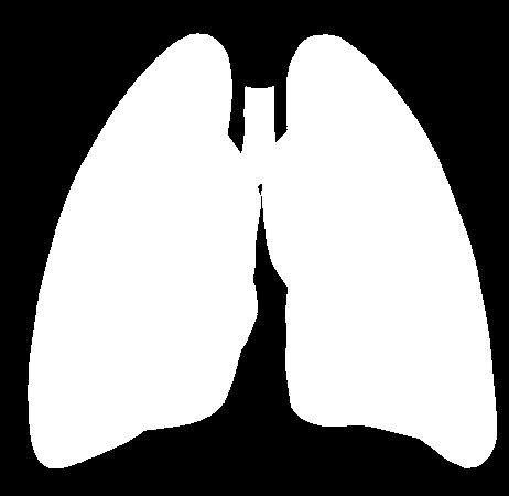 + Anatomia radiologiczna klatki piersiowej Segmenty oskrzelowo-płucne Płuco lewe Płuco prawe Płat górny szczytowy (apicale)* 1. szczytowy (apicale) tylny (posterius)* 2.