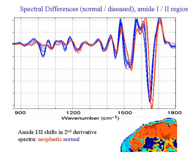 różnice spektralne w zakresie pasm amidowych I/ II wywołane zmianami