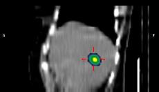 99m Tc erytrocyty