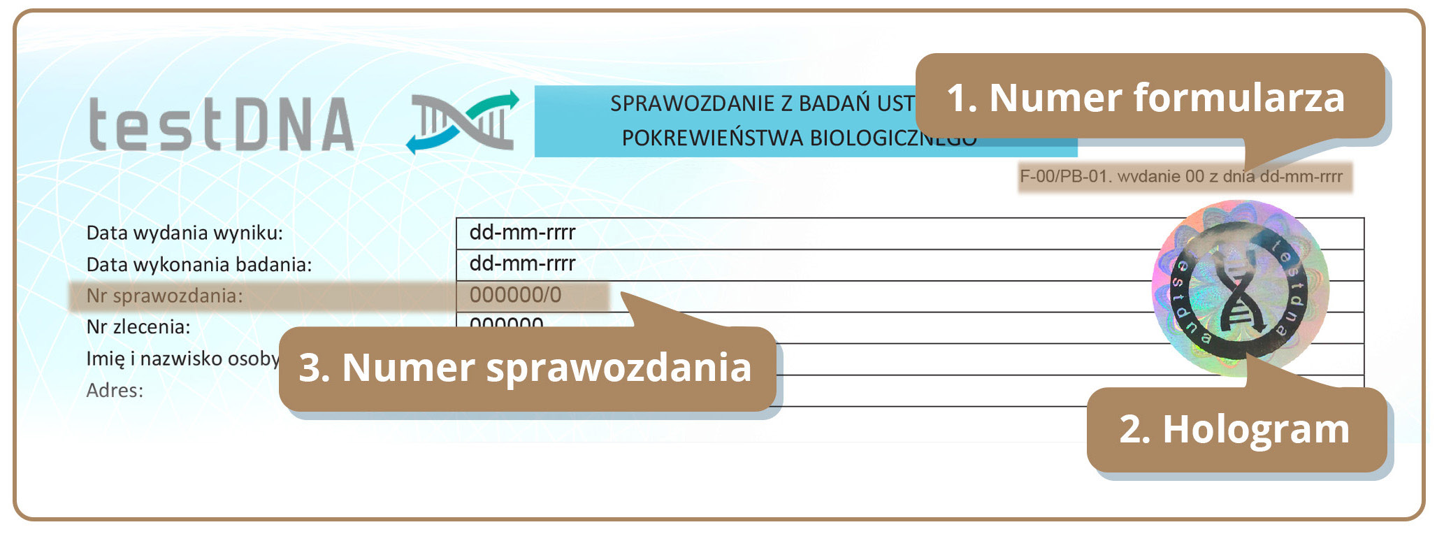 MATERIAŁY INFORMACYJNE Oto 11 ważnych informacji zawartych na naszych wynikach, które posiadają konkretne znaczenie dla pewności badania ojcostwa i samego wyniku 1. Numer formularza (np.