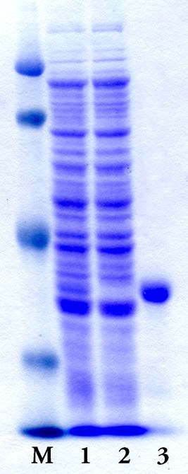 234 W. Rastawicki i inni Nr 3 Ryc. 1. Elektroforegramy białek pałeczek E. coli BL21 (DE3) oraz rekombinowanego białka P1 M. pneumoniae uzyskane w trakcie jego oczyszczania.