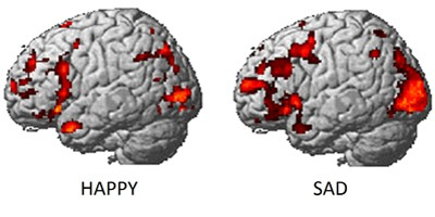 Functional MRI (fmri) - reakcja mózgu na bodźce Obraz fmri: sygnałbold (ang,blood Oxygen Level Dependent; zależność intensywności sygnału