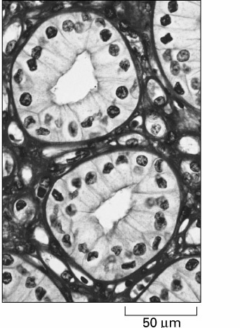 Wizualizacja struktury komórki Klasyczne barwienia cytologiczne (histologiczne) Metody immunocytochemiczne oparte na wysokiej swoistości wiązania antygenu z przeciwciałem Autoradiografia metoda