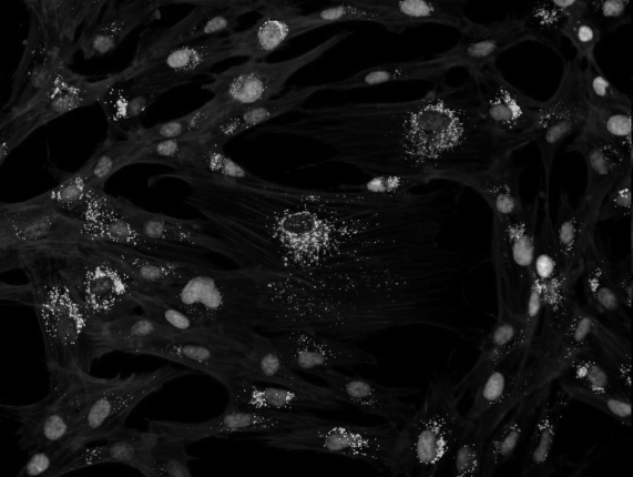 Immunocytochemia Znaczniki: fluorochromy enzymy metale cięzkie antygen -kaŝda substancja w komórce, która ma właściwości