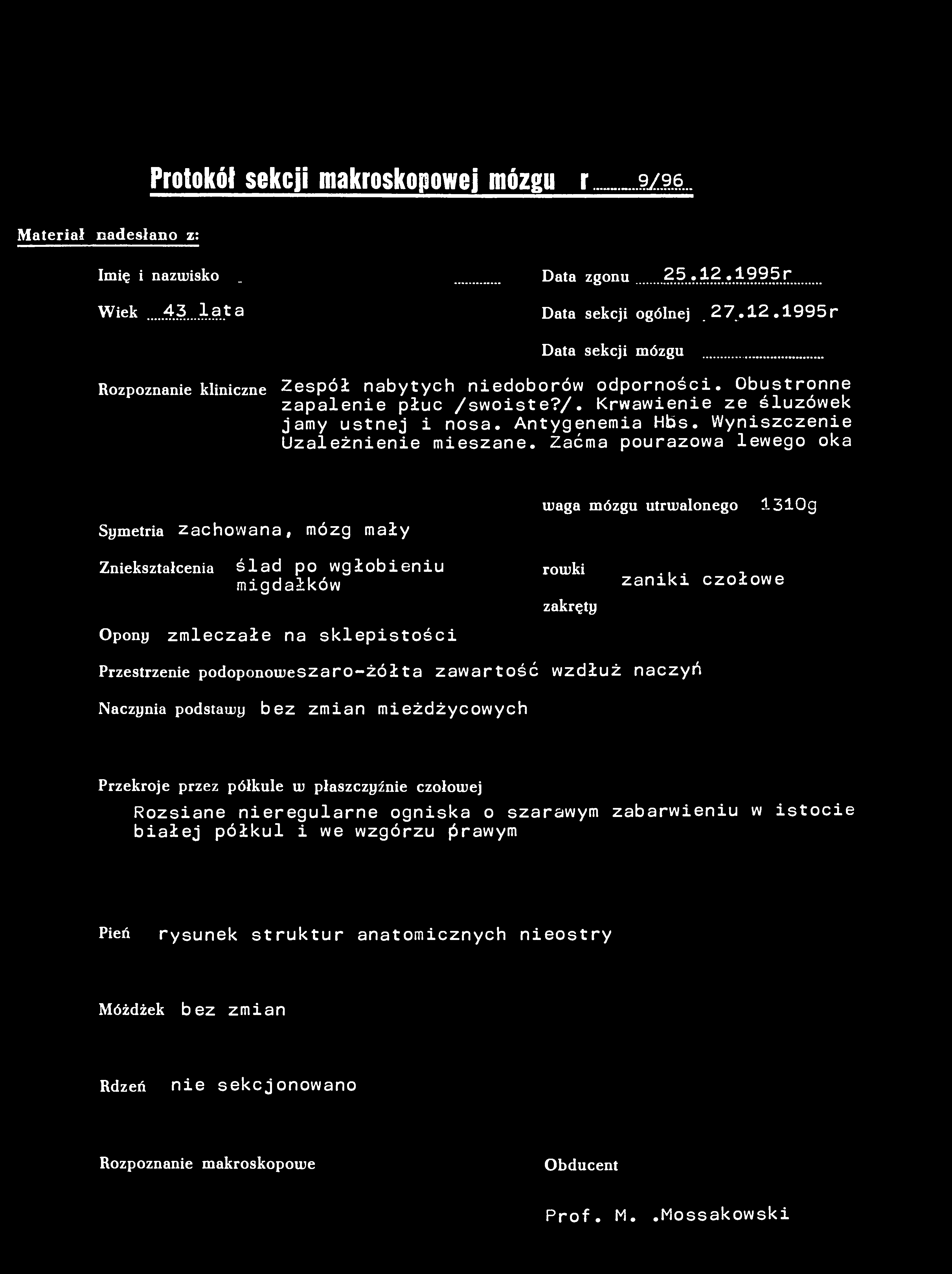 Protokół sekcji makroskopowej mózgu nr 9/96. Materiał nadesłano z; Imię i nazwisko Data zgonu 25.12,1995r Wiek...43... lat a Data sekcji ogólnej.27..12.1995 r Data sekcji mózgu Rozpoznanie kliniczne Zespół nabytych niedoborów odporności.