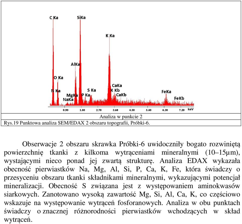 Analiza EDAX wykazała obecność pierwiastków Na, Mg, Al, Si, P, Ca, K, Fe, która świadczy o przesyceniu obszaru tkanki składnikami mineralnymi, wykazującymi potencjał mineralizacji.