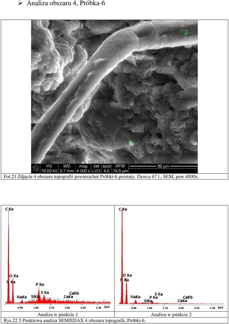 prostaty. Dawca 67 l., SEM, pow.4000x.