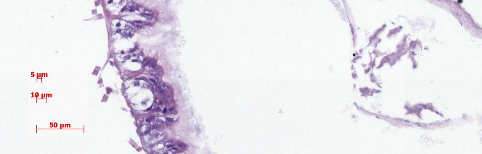 4 Szymaś B., Przybył A., 2007. Midgut histological picture of the honey bee (Apis mellifera L.) following consumption Fig. 2. Microscopic picture of midgut of a bee fed on sugar syrup.