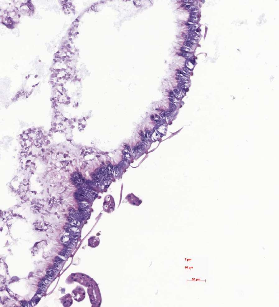 Szymaś B., Przybył A., 2007. Midgut histological picture of the honey bee (Apis mellifera L.) following consumption 5 Fig. 4.