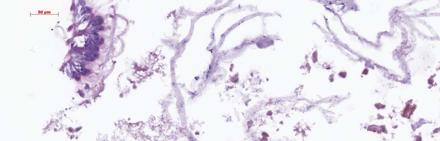 6 Szymaś B., Przybył A., 2007. Midgut histological picture of the honey bee (Apis mellifera L.) following consumption Fig. 6.