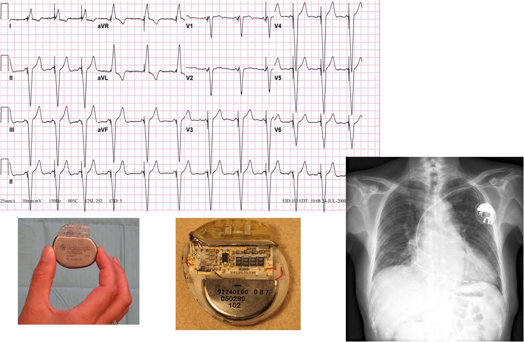 EKG kryteria interpretacyjne