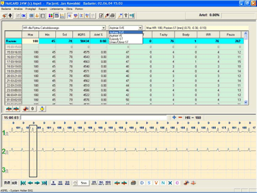 Holterowskie EKG (24 godz.