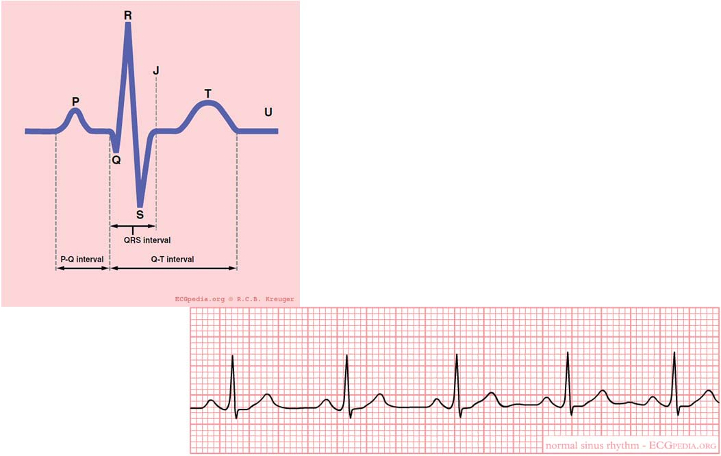 EKG zapis papierowy