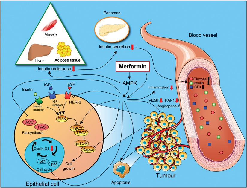 Mechanizmy przeciwnowotworowego działania metforminy