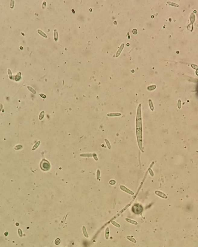 Biodiversity of fungi colonizing hull-less seed squash... 41 Phot. 1. Macro- and microconidia of F. oxysporum (optical microscope 40) (photo A. Jamiołkowska) Fot. 1. Makro- i mikrokonidia F.