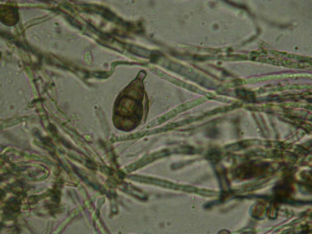 Biodiversity of fungi colonizing hull-less seed squash... 43 a) b) Phot. 2. Macroconidia (a) and chlamydospores (b) of F. equiseti (optical microscope 40) (photo A. Hamood Thanoon) Fot. 2. Makrokonidia (a) i chlamydospory (b) F.