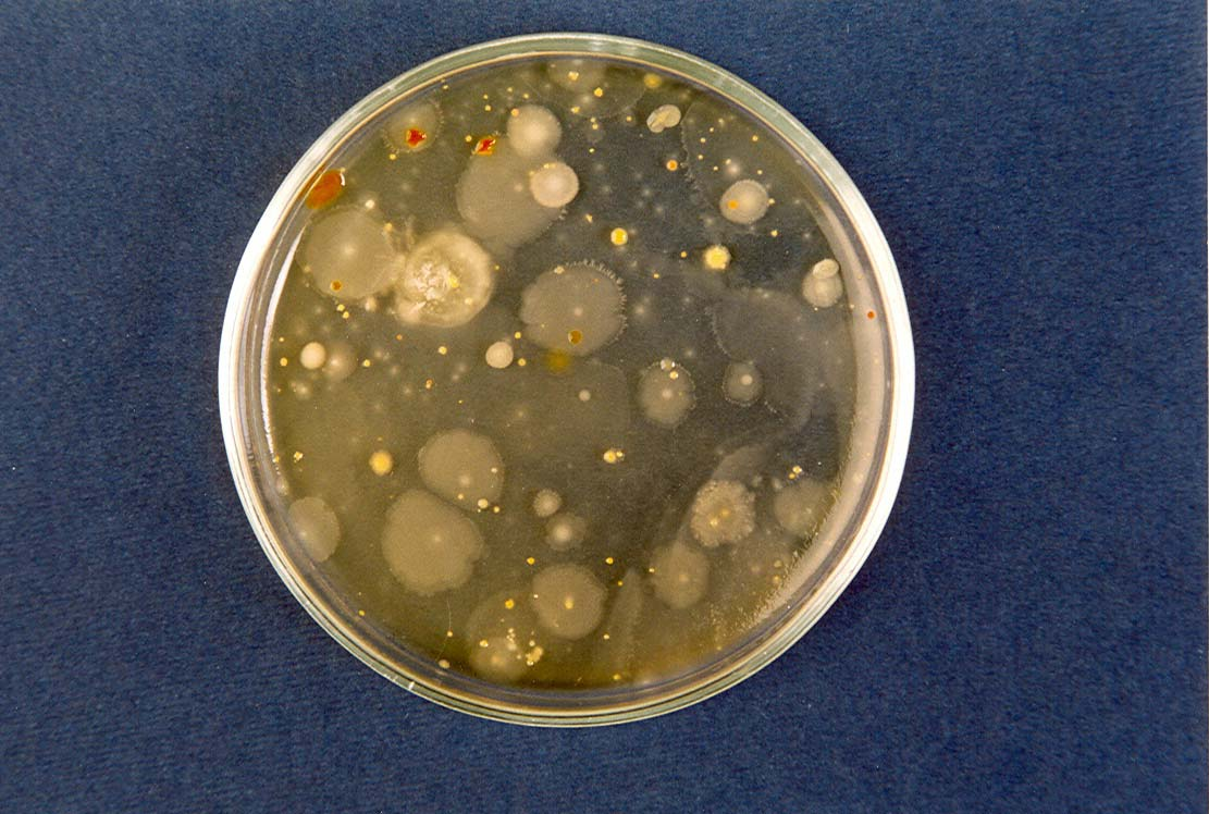 Fot. 4. Kolonie mikroorganizmów rozkładających polimery płuczkowe typu KMC, KMS i PHPA Fot. 5.