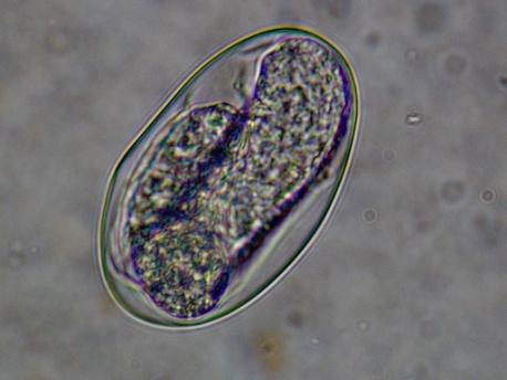 Tęgoryjce (Ancylostoma i Uncinaria) Te niewielkie nicienie (1-2 cm) pasożytują w jelicie cienkim. Ich nazwa pochodzi od dużej torebki gębowej*, za pomocą której przyczepiają się do ściany jelita.