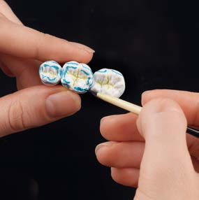 Całkowicie anatomiczne Indywidualne korony na zęby boczne Przykładowe wykonanie ceramill mind ceramill