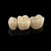 ceramill motion Wyfrezowane uzupełnienie z Ceramill Zolid FX (strategia frezowania Ceramill HD