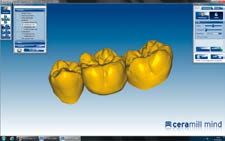 roztworze odcieni zębinowych A-D Ceramill Liquid FX Szczegółowe parametry podbarwiania patrz