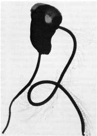 APICOMPLEXA SPOROZOA pasożytnictwo