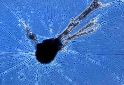 FORAMINIFERA OTWORNICE bentosowe reticulopodia