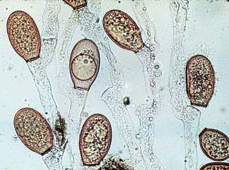 CHYTRIDIOMYCETES GRZYBY wiciowe Chytridiales Blastocladiales zarodniki