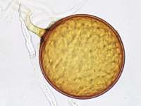 ZYGOMYCETES GRZYBY